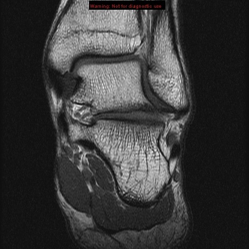 Ankle MRI Anatomy