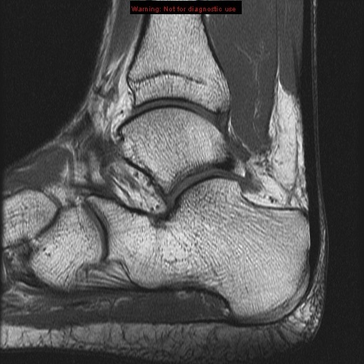 Sagittal