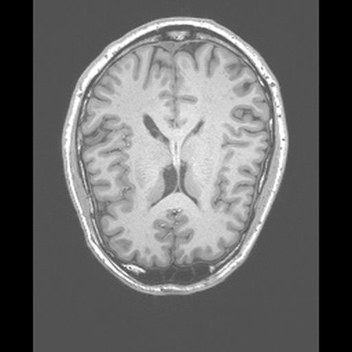 Brain MRI Anatomy