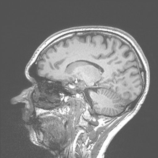 Sagittal