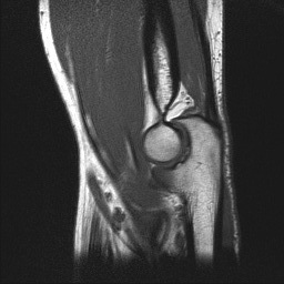 Sagittal