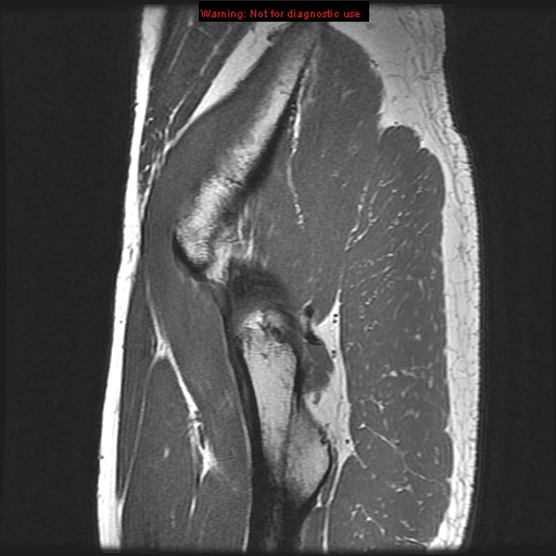 Sagittal