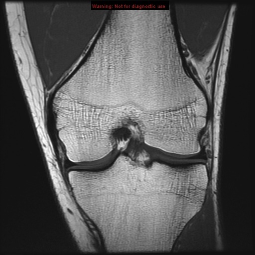 Knee MRI Anatomy