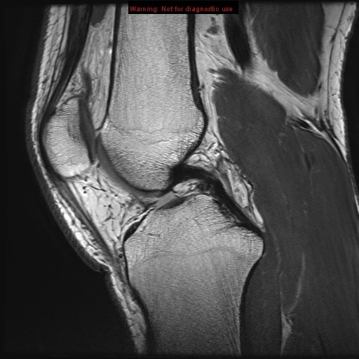 Sagittal