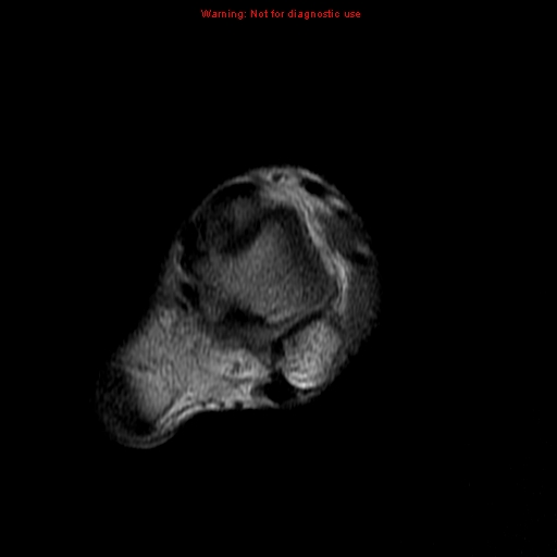 Lower Leg MRI Anatomy