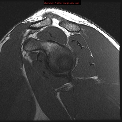 Sagittal
